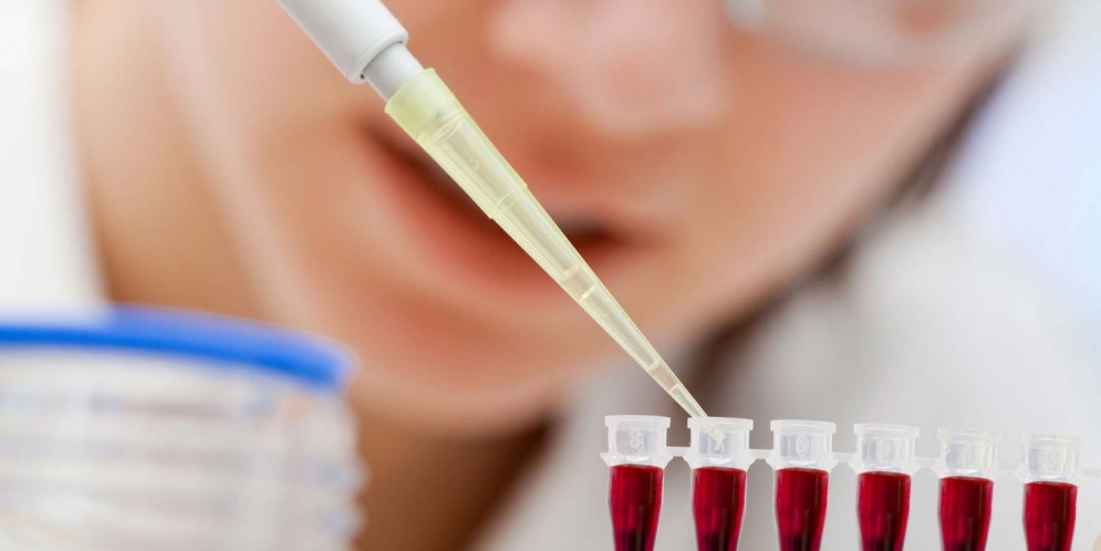 Hội chứng thực bào máu - Hình ảnh minh họa